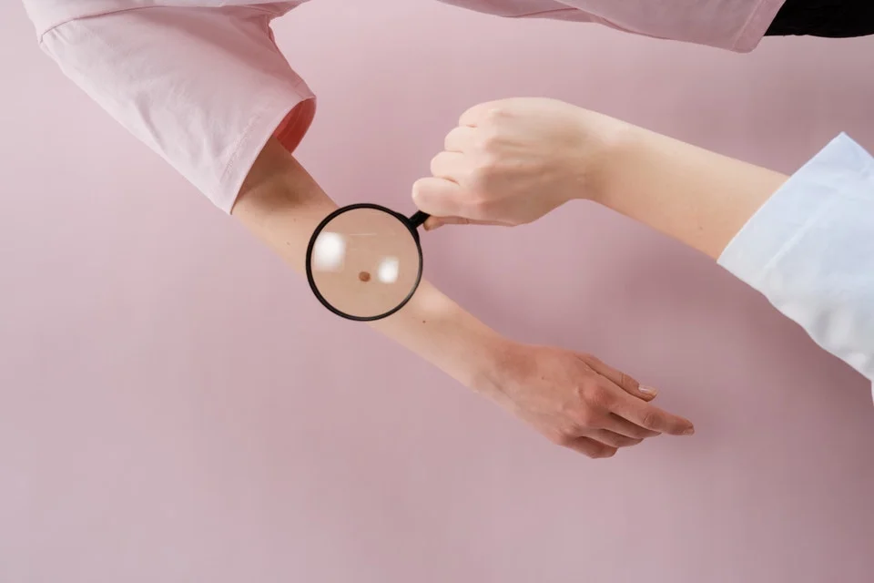 Dermatología